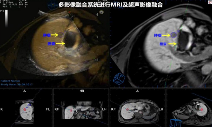 QQ浏览器截屏未命名